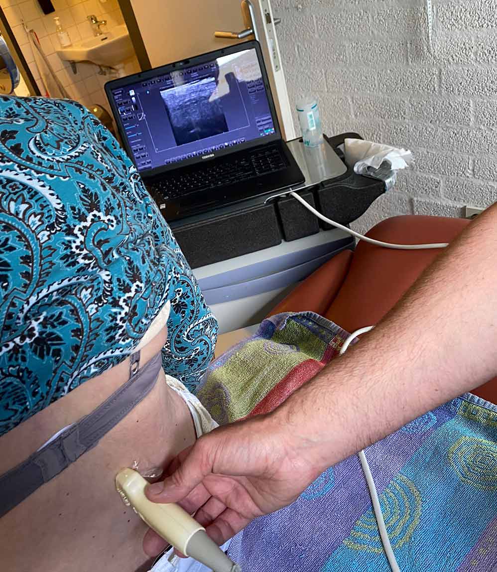 Echografisch onderzoek van de onderrug, met het echobeeld live op het scherm van een laptop