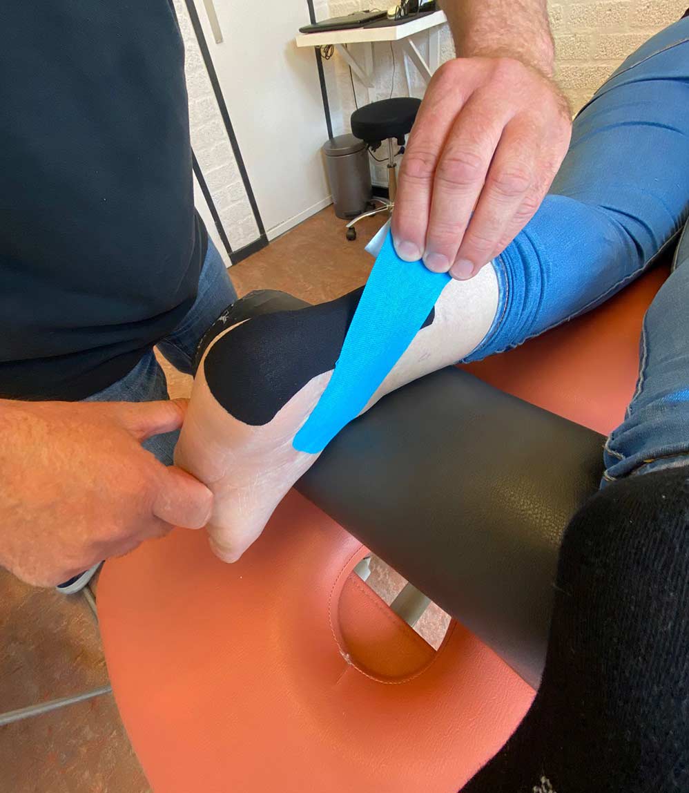 Fysiotherapeut brengt blauwe tape aan op de enkel en voet van een patiënt